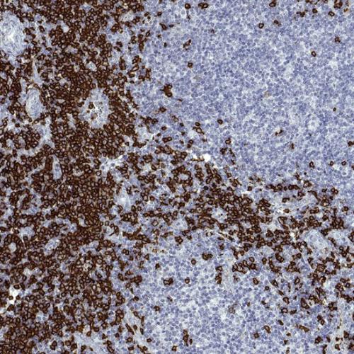 CD20 Antibody Reagent for Immunohistochemistry