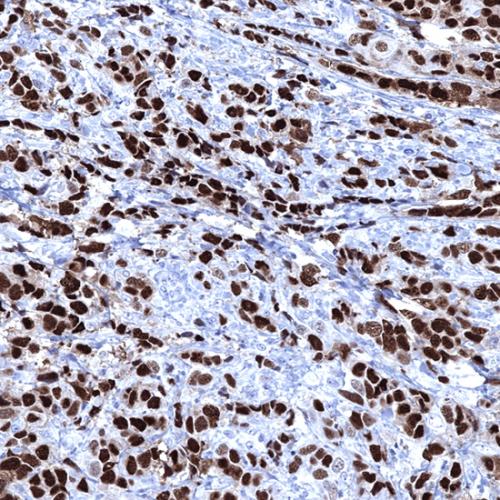 Progesterone Receptor (PR) Antibody Reagent for Immunohistochemistry