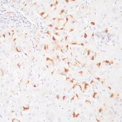 HBsAg Antibody Reagent for Immunohistochemistry