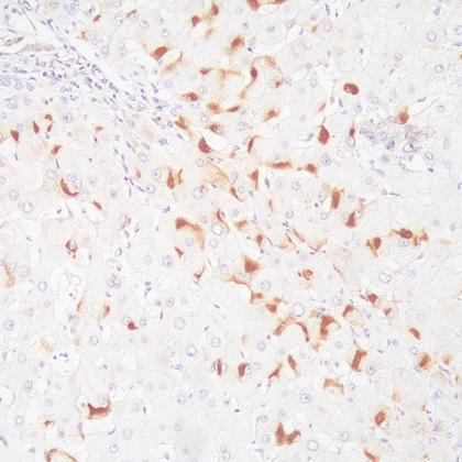 HBsAg Antibody Reagent for Immunohistochemistry