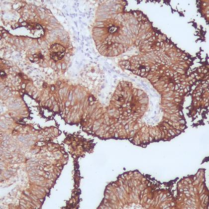 CEA Antibody Reagent for Immunohistochemistry