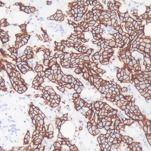 HER-2 Antibody Reagent for Immunohistochemistry