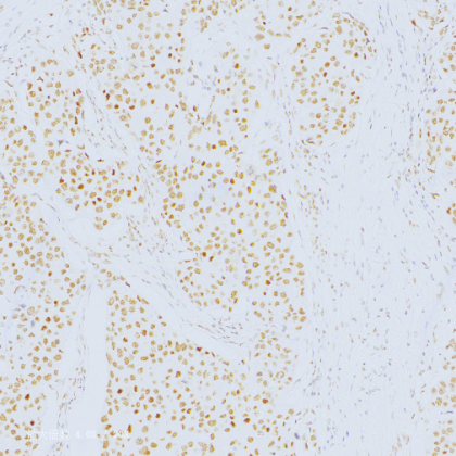 INI-1 Antibody Reagent for Immunohistochemistry